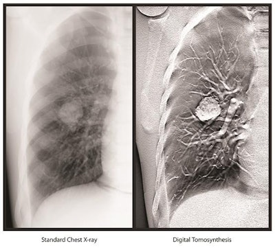 Image courtesy of Carestream.