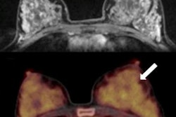 2020 01 22 20 14 2351 2020 01 23 Pet Mri Breast Thumb