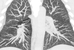 2020 01 24 00 20 4584 2020 01 28 Ct Evali 20200128180422