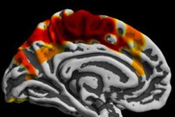 2020 01 24 23 09 8577 Plos One Mri Brains Air Pollution 20200125000552