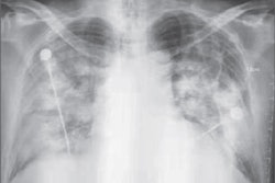 2020 01 24 23 14 8209 Coronavirus X Ray A 400
