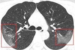 2020 01 31 20 17 1387 2020 01 31 Ct Coronavirus Thumb