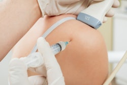 2019 07 19 21 42 4278 Ultrasound Shoulder Injection 400