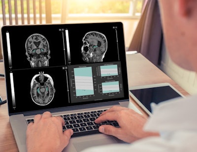 QyScore software. Image courtesy of Qynapse.