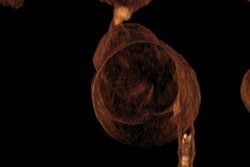 2020 02 06 18 09 8100 2020 02 07 3 D Printed Aorta 20200206180603