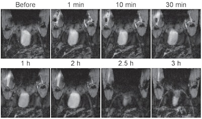 MR images of a mouse before and after an intramuscular injection of the probe show that with the protective molecular structure around the probe, it maintained its contrast for up to two hours. Images courtesy of Gassensmith et al and the University of Texas at Dallas.