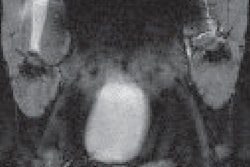 2020 02 07 21 15 8311 2020 02 10 Orca Mri Thumb