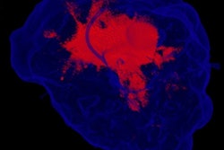 2020 02 10 21 18 8019 2020 02 10 Micro Ct Breast Thumb