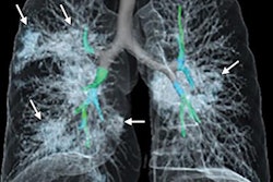 2020 02 12 20 26 5779 2020 02 12 Coronavirus 20200212203002