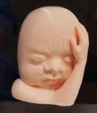 3D-printed model of a fetus' face based on ultrasound scans. Image courtesy of Amy Brack, PhD.