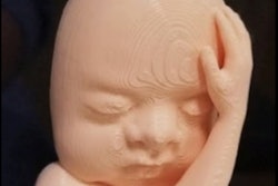 2020 02 14 21 46 4227 2020 02 18 3 D Printed Fetus 400
