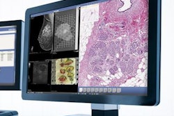 2020 02 20 21 49 3400 Sectra Vna Rad Path 20200220212927