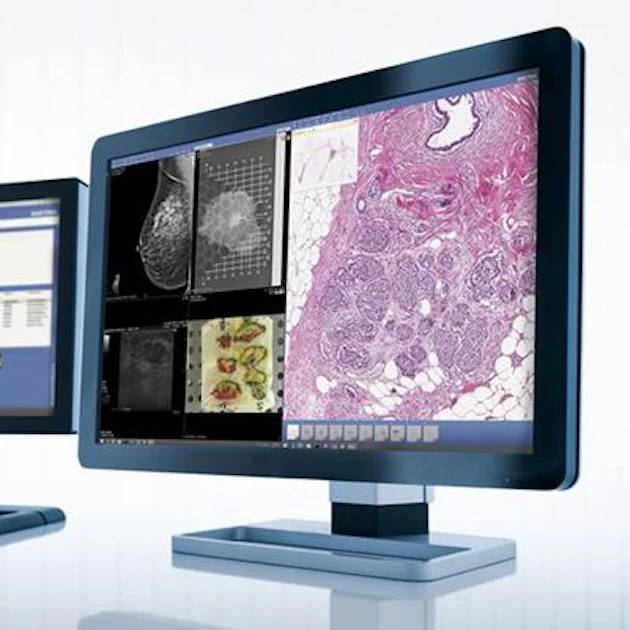 Mapping System Pathology Shared systems enable digital pathology deployments: Part 2 | AuntMinnie