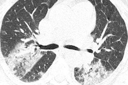 2020 02 21 00 47 5792 2020 02 21 Ct Coronavirus 400