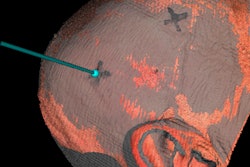 2020 02 21 20 52 7890 2020 02 24 3 D Scan Head 20200221204616