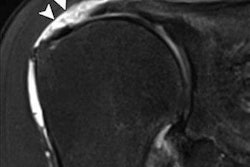 2020 02 24 22 13 4556 2020 02 25 Mri Shoulder A 20200224225834