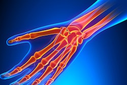 2019 01 30 23 23 2626 Hand Wrist 400