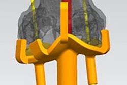 2020 03 02 20 42 4659 2020 03 02 3 D Printing Knee 400