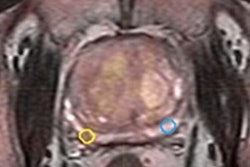 2020 03 03 18 09 5325 Choline Pet Mp Mri Prostate Am Mol Insider 20200303185713