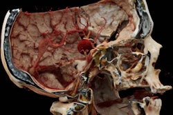 2020 03 05 01 00 2035 2020 03 05 Cinematic Rendering Thumb