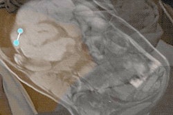 2020 03 05 18 36 1962 2020 03 09 Ar Thumb