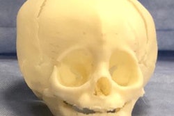 2020 03 27 16 05 0365 2020 03 37 3 D Printing Skull 20200327164707