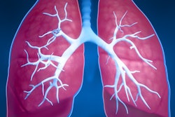 2017 12 20 17 16 6396 Lung General 400