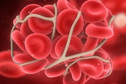 2018 05 16 00 48 5597 Blood Clot 400