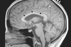 2020 04 10 22 11 5954 2020 04 14 Mri Astronauts Brain Images 400