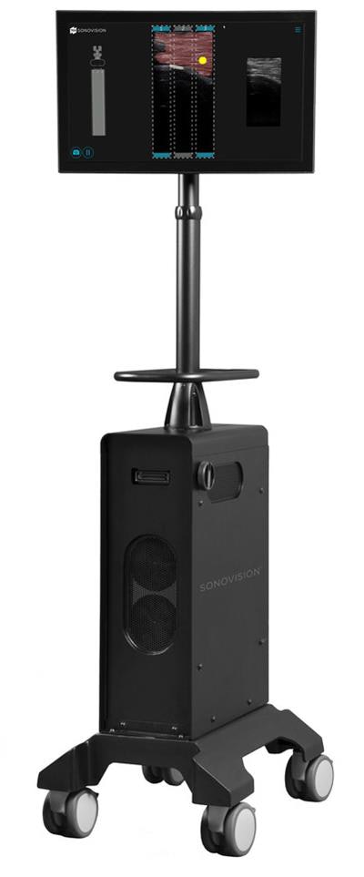 The SonoVision scanner from Tissue Differentiation Intelligence (TDI). Image courtesy of TDI.