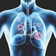 2020 04 15 20 00 7340 Coronavirus Cells Lungs 400