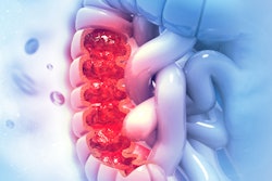 2020 04 17 23 02 9892 Colon Disease 400