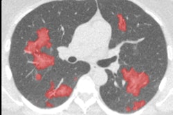 2020 04 21 16 32 5792 2020 04 21 Cad4 Covid Ct 400