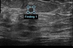 2020 04 23 23 33 3240 2020 04 24 Ai Breast Us 20200423233617