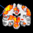 2020 04 27 19 46 5887 2020 04 27 F Mri Desmond Hrf Results 20200427191314
