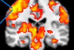 2020 04 27 19 46 5887 2020 04 27 F Mri Desmond Hrf Results 20200427191314