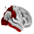 2020 04 27 22 23 4623 2020 04 28 Qsm Mri Pet Tau Overlay Spotorno 400