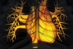 2019 03 25 23 23 9633 Heart Yellow 400