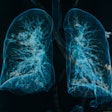 2019 04 25 20 01 3039 Lung 3 D 400