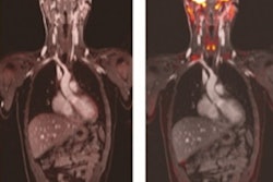 2020 05 05 20 05 9765 2020 05 05 Dw Mri Ped Cancer Figure 2 400