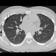 2020 05 05 23 27 7207 2020 05 07 Ct Peds Handlebar Injuries Figure 1 400