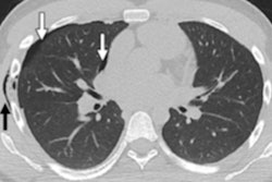 2020 05 05 23 27 7207 2020 05 07 Ct Peds Handlebar Injuries Figure 1 400