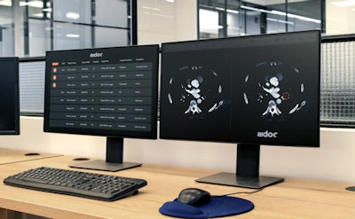 Aidoc's software for incidental detection and triage of COVID-19 cases on CT.