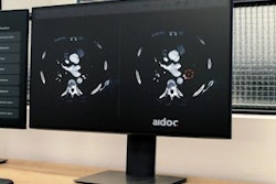 2020 05 08 16 58 9389 2020 05 08 Aidoc 20200508160253