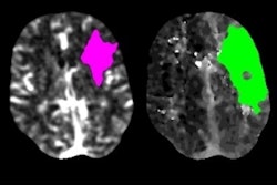 2020 05 08 21 26 3029 2020 05 08 Stroke Kansagra 400