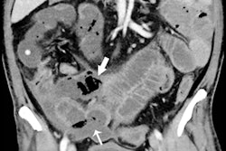 2020 05 12 20 38 9415 2020 05 12 Rsna Abdominal 400