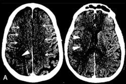 2020 05 15 18 45 6754 2020 05 15 Ajnr Ct Scans 400