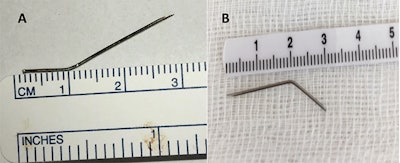 A: The needle removed from the woman's neck. B: The simulated needle, which shows they are almost identical.