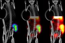 2020 05 18 21 50 0584 2020 05 18 Lu177 Dotatate Neuroendocrine Jnm O Neill 20200518212224