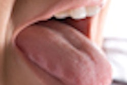 2020 05 20 21 16 1503 Tongue 400